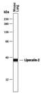 Lipocalin 2 antibody, PA5-46916, Invitrogen Antibodies, Western Blot image 