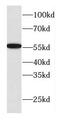 DnaJ Heat Shock Protein Family (Hsp40) Member C7 antibody, FNab02469, FineTest, Western Blot image 