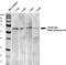 Calcium Voltage-Gated Channel Auxiliary Subunit Gamma 2 antibody, TA326520, Origene, Western Blot image 