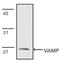 Vesicle Associated Membrane Protein 2 antibody, M02331, Boster Biological Technology, Western Blot image 