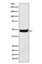 Betaine--Homocysteine S-Methyltransferase antibody, M06712-2, Boster Biological Technology, Western Blot image 