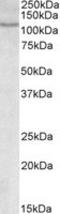 Nuclear Factor Of Activated T Cells 2 antibody, LS-B4464, Lifespan Biosciences, Western Blot image 