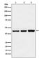 Protein Arginine Methyltransferase 6 antibody, M02924-2, Boster Biological Technology, Western Blot image 