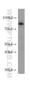 Embryonal Fyn-Associated Substrate antibody, 20538-1-AP, Proteintech Group, Western Blot image 