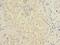 BEN Domain Containing 7 antibody, A58254-100, Epigentek, Immunohistochemistry paraffin image 