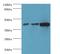 Protein Phosphatase Methylesterase 1 antibody, LS-C370145, Lifespan Biosciences, Western Blot image 