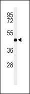 Lecithin-Cholesterol Acyltransferase antibody, 64-157, ProSci, Western Blot image 