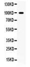 TNF Receptor Superfamily Member 11a antibody, LS-C357598, Lifespan Biosciences, Western Blot image 