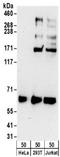 Ribophorin II antibody, NBP2-32178, Novus Biologicals, Western Blot image 
