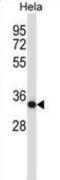 Casein Kinase 2 Alpha 1 antibody, abx027616, Abbexa, Western Blot image 