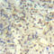 Cofilin 1 antibody, STJ22069, St John