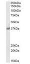 Sarcoglycan Delta antibody, orb372999, Biorbyt, Western Blot image 