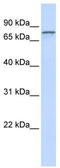 ADAM Metallopeptidase Domain 15 antibody, TA339378, Origene, Western Blot image 