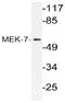 Mitogen-Activated Protein Kinase Kinase 7 antibody, AP21117PU-N, Origene, Western Blot image 