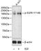 EGFR antibody, A00023Y1148, Boster Biological Technology, Western Blot image 