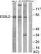 EPS8 Like 2 antibody, TA315746, Origene, Western Blot image 