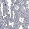 Forkhead Box J1 antibody, NBP2-59033, Novus Biologicals, Immunohistochemistry frozen image 