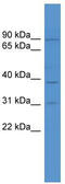 TBC1 Domain Family Member 26 antibody, TA333422, Origene, Western Blot image 