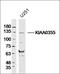 DOT1 Like Histone Lysine Methyltransferase antibody, orb184545, Biorbyt, Western Blot image 