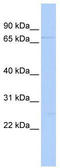 DEAD-Box Helicase 59 antibody, TA341624, Origene, Western Blot image 