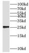 P2 antibody, FNab06531, FineTest, Western Blot image 
