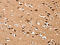 Dishevelled Associated Activator Of Morphogenesis 1 antibody, CSB-PA184126, Cusabio, Immunohistochemistry paraffin image 