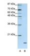 Apolipoprotein O antibody, orb324922, Biorbyt, Western Blot image 