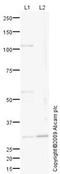 Iodothyronine Deiodinase 2 antibody, ab77779, Abcam, Western Blot image 