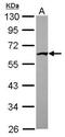 Interferon-induced protein with tetratricopeptide repeats 1 antibody, PA5-31254, Invitrogen Antibodies, Western Blot image 