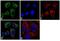 Keratin 8 antibody, MA5-14476, Invitrogen Antibodies, Immunofluorescence image 