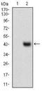 Melanoma Cell Adhesion Molecule antibody, NBP2-37318, Novus Biologicals, Western Blot image 