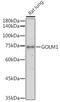 Golgi Membrane Protein 1 antibody, GTX64452, GeneTex, Western Blot image 