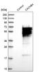 Calcium Voltage-Gated Channel Auxiliary Subunit Beta 4 antibody, HPA015601, Atlas Antibodies, Western Blot image 