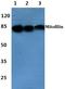 Inner Membrane Mitochondrial Protein antibody, A04102, Boster Biological Technology, Western Blot image 