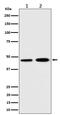 Translocase Of Inner Mitochondrial Membrane 44 antibody, M10278, Boster Biological Technology, Western Blot image 