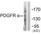 Platelet Derived Growth Factor Receptor Alpha antibody, LS-C118555, Lifespan Biosciences, Western Blot image 