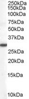 Dimethylarginine Dimethylaminohydrolase 2 antibody, 45-469, ProSci, Western Blot image 