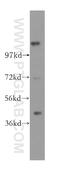 TIMELESS-interacting protein antibody, 11972-2-AP, Proteintech Group, Western Blot image 