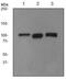 Inositol Polyphosphate-4-Phosphatase Type II B antibody, ab81269, Abcam, Western Blot image 