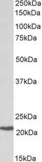 Core-Binding Factor Subunit Beta antibody, LS-C204982, Lifespan Biosciences, Western Blot image 