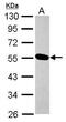 Ubiquitin Conjugating Enzyme E2 O antibody, PA5-31429, Invitrogen Antibodies, Western Blot image 