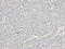 DEAD-Box Helicase 5 antibody, A00670-1, Boster Biological Technology, Immunohistochemistry frozen image 