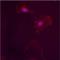 Estrogen receptor beta antibody, ALX-210-135-C050, Enzo Life Sciences, Immunofluorescence image 