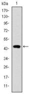 Troponin I2, Fast Skeletal Type antibody, GTX60509, GeneTex, Western Blot image 