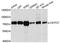 Cleavage Stimulation Factor Subunit 2 Tau Variant antibody, A4540, ABclonal Technology, Western Blot image 