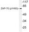 Zeta Chain Of T Cell Receptor Associated Protein Kinase 70 antibody, LS-C178009, Lifespan Biosciences, Western Blot image 