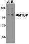 MDM2 Binding Protein antibody, A08842, Boster Biological Technology, Western Blot image 