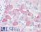 Lysyl Oxidase Like 2 antibody, LS-A9354, Lifespan Biosciences, Immunohistochemistry paraffin image 