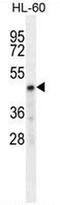 Carbohydrate Sulfotransferase 2 antibody, AP50911PU-N, Origene, Western Blot image 