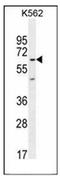 Kelch Like Family Member 40 antibody, AP52295PU-N, Origene, Western Blot image 